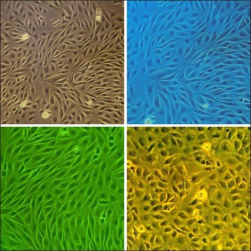 Bovine Brain Microvascular Endothelial Cells: BBMVEC (Cryovial)