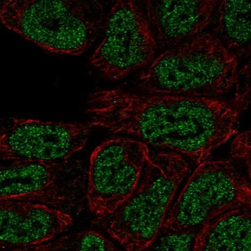 Anti-PRKCB antibody produced in rabbit Prestige Antibodies&#174; Powered by Atlas Antibodies, affinity isolated antibody