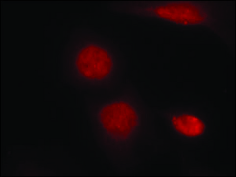 Anti-phospho-AR (pSer213) antibody produced in rabbit affinity isolated antibody