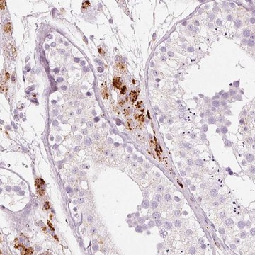 Anti-LECT2 antibody produced in rabbit Prestige Antibodies&#174; Powered by Atlas Antibodies, affinity isolated antibody, buffered aqueous glycerol solution