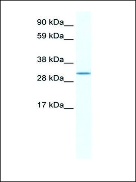 Anti-SPIC antibody produced in rabbit IgG fraction of antiserum