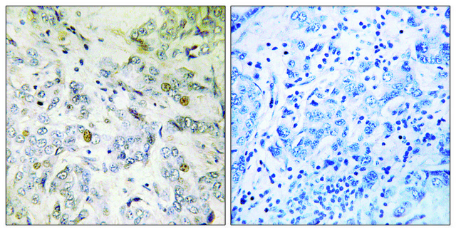 Anti-HCC1 antibody produced in rabbit affinity isolated antibody