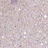 Anti-BLMH antibody produced in rabbit Prestige Antibodies® Powered by Atlas Antibodies, affinity isolated antibody, buffered aqueous glycerol solution