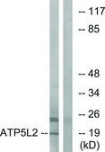 Anti-ATP5L2 antibody produced in rabbit affinity isolated antibody