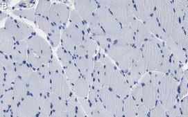 Anti-JPH2 Antibody, clone 1O14 ZooMAb® Rabbit Monoclonal recombinant, expressed in HEK 293 cells