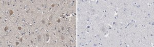 Anti-Akt Antibody, PH Domain Antibody, clone SKB1 ZooMAb® Mouse Monoclonal recombinant, expressed in HEK 293 cells