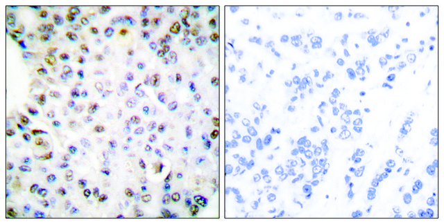 Anti-Retinoid X Receptor &#947; antibody produced in rabbit affinity isolated antibody