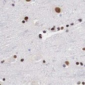 Anti-SF3A1 antibody produced in rabbit Prestige Antibodies® Powered by Atlas Antibodies, affinity isolated antibody, buffered aqueous glycerol solution