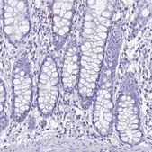 Anti-CST5 antibody produced in rabbit Prestige Antibodies® Powered by Atlas Antibodies, affinity isolated antibody, buffered aqueous glycerol solution