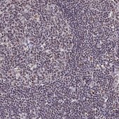 Anti-RAVER1 antibody produced in rabbit Prestige Antibodies® Powered by Atlas Antibodies, affinity isolated antibody, buffered aqueous glycerol solution