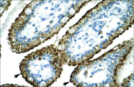 Anti-GABRP antibody produced in rabbit affinity isolated antibody