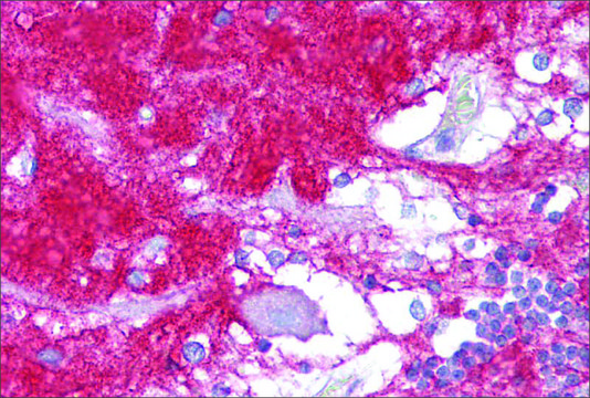 Anti-GNAO1 antibody produced in rabbit affinity isolated antibody