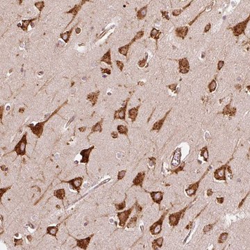 Anti-KLC1 antibody produced in rabbit Prestige Antibodies&#174; Powered by Atlas Antibodies, affinity isolated antibody, buffered aqueous glycerol solution