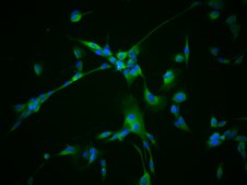 YUMM2.1 Mouse Melanoma Cell Line