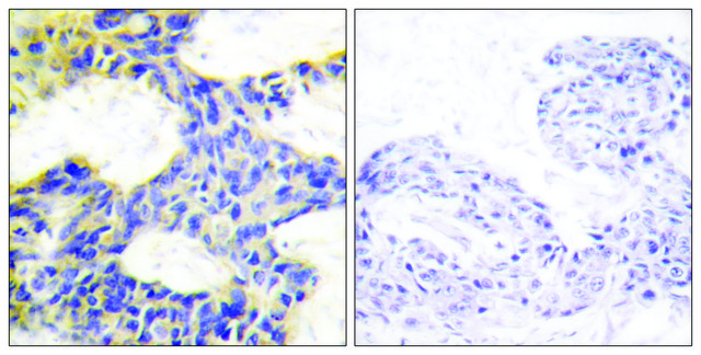 Anti-S6K antibody produced in rabbit affinity isolated antibody