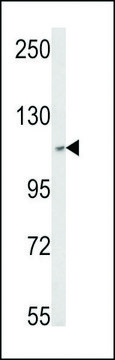 ANTI-SKIV2L2 (CENTER) antibody produced in rabbit affinity isolated antibody, buffered aqueous solution