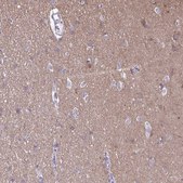 Anti-RTN1 antibody produced in rabbit Prestige Antibodies® Powered by Atlas Antibodies, affinity isolated antibody, buffered aqueous glycerol solution