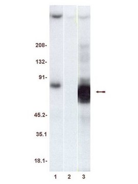 ZAP-70 Protein, active, 20 &#181;g Active, recombinant, human, full length ZAP-70 containing a C-terminal His6 tag, for use in Kinase Assays.