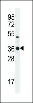 ANTI-TPSD1 (C-TERM) antibody produced in rabbit IgG fraction of antiserum, buffered aqueous solution