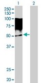 Anti-TRIM55 antibody produced in rabbit IgG fraction of antiserum, buffered aqueous solution