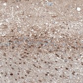 Anti-TMEM255A antibody produced in rabbit Prestige Antibodies® Powered by Atlas Antibodies, affinity isolated antibody, buffered aqueous glycerol solution