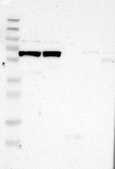 Anti-P3H2 antibody produced in rabbit Prestige Antibodies® Powered by Atlas Antibodies, affinity isolated antibody, buffered aqueous glycerol solution