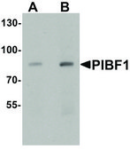 Anti-PIBF1 antibody produced in rabbit affinity isolated antibody