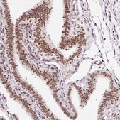 Anti-HNRNPC antibody produced in rabbit Prestige Antibodies® Powered by Atlas Antibodies, affinity isolated antibody, buffered aqueous glycerol solution
