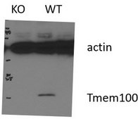 Anti-TMEM100 from rabbit, purified by affinity chromatography