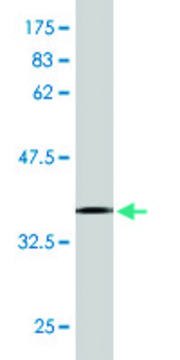 Monoclonal Anti-ASCC2, (C-terminal) antibody produced in mouse clone 2F7, ascites fluid