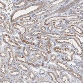 Anti-CTAGE5 antibody produced in rabbit Prestige Antibodies® Powered by Atlas Antibodies, affinity isolated antibody, buffered aqueous glycerol solution