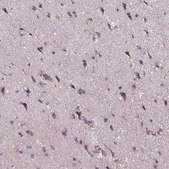 Anti-MLC1 antibody produced in rabbit Prestige Antibodies® Powered by Atlas Antibodies, affinity isolated antibody, buffered aqueous glycerol solution