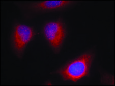 Anti-PRKCQ (Ab-676) antibody produced in rabbit affinity isolated antibody