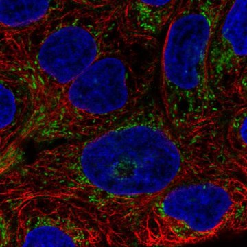 Anti-AIM2 antibody produced in rabbit Prestige Antibodies&#174; Powered by Atlas Antibodies, affinity isolated antibody