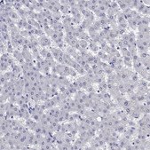 Anti-SH2D7 antibody produced in rabbit Prestige Antibodies® Powered by Atlas Antibodies, affinity isolated antibody, buffered aqueous glycerol solution