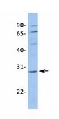 Anti-KCTD11 antibody produced in rabbit affinity isolated antibody