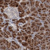 Anti-ADRB2 antibody produced in rabbit Prestige Antibodies&#174; Powered by Atlas Antibodies, affinity isolated antibody, buffered aqueous glycerol solution