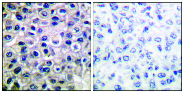 Anti-MMP-14 antibody produced in rabbit affinity isolated antibody