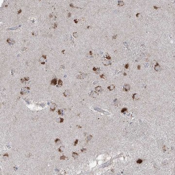 Anti-AGPS antibody produced in rabbit Prestige Antibodies&#174; Powered by Atlas Antibodies, affinity isolated antibody, buffered aqueous glycerol solution, ab1