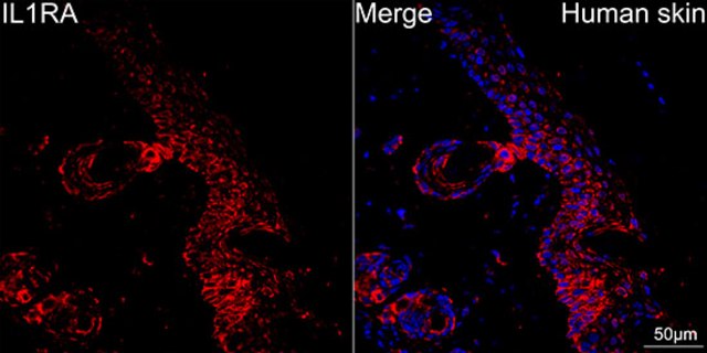 Anti-IL1RA Antibody, clone 4V9E1, Rabbit Monoclonal