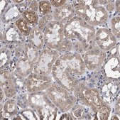 Anti-GRHPR antibody produced in rabbit Prestige Antibodies® Powered by Atlas Antibodies, affinity isolated antibody, buffered aqueous glycerol solution