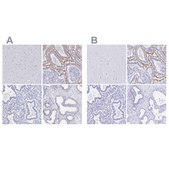 Anti-SLC5A1 antibody produced in rabbit Prestige Antibodies® Powered by Atlas Antibodies, affinity isolated antibody, buffered aqueous glycerol solution