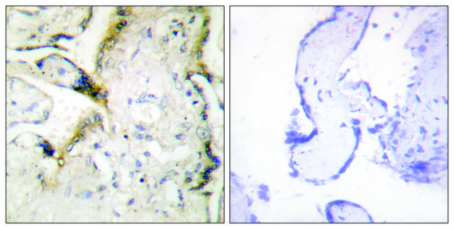 Anti-LAMA2 antibody produced in rabbit affinity isolated antibody