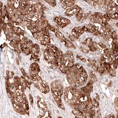 Monoclonal Anti-Msln Antibody Produced In Mouse Prestige Antibodies® Powered by Atlas Antibodies, clone CL13957, affinity isolated antibody, buffered aqueous glycerol solution