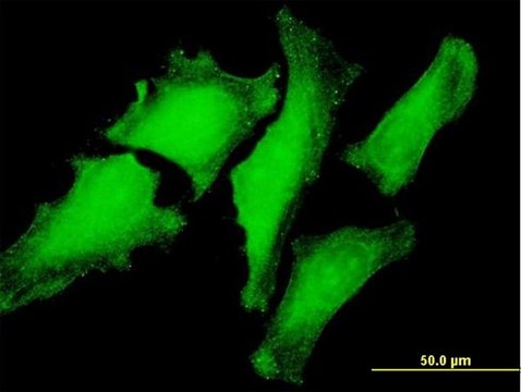 Anti-VBP1 antibody produced in mouse purified immunoglobulin, buffered aqueous solution