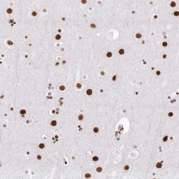 Anti-DHX9 antibody produced in rabbit Prestige Antibodies&#174; Powered by Atlas Antibodies, affinity isolated antibody, buffered aqueous glycerol solution