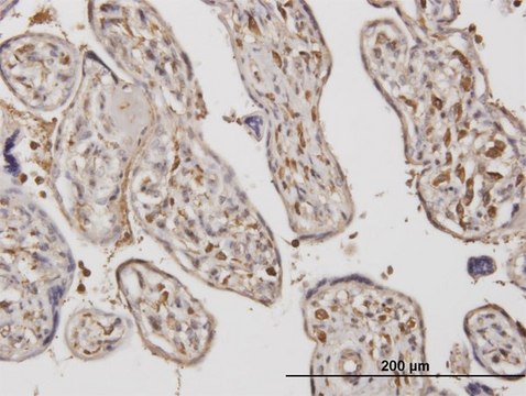 Monoclonal Anti-ADAMTS17 antibody produced in mouse clone 3B7, purified immunoglobulin, buffered aqueous solution