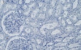 Anti-Frataxin Antibody, clone 2F3 ZooMAb® Rabbit Monoclonal recombinant, expressed in HEK 293 cells