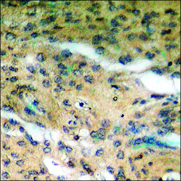 Anti-phospho-CRYAB (pSer19) antibody produced in rabbit affinity isolated antibody