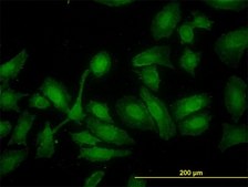 Monoclonal Anti-HADHSC antibody produced in mouse clone 4B5, purified immunoglobulin, buffered aqueous solution